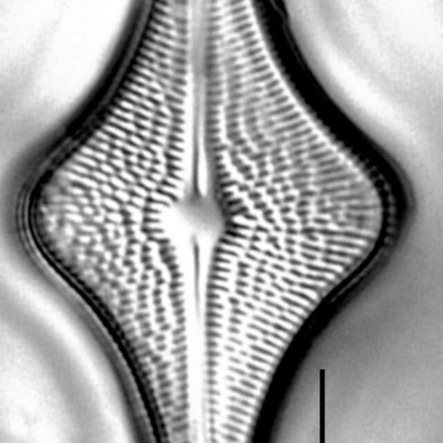 Brachysira follis LM7