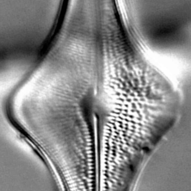 Brachysira follis LM1