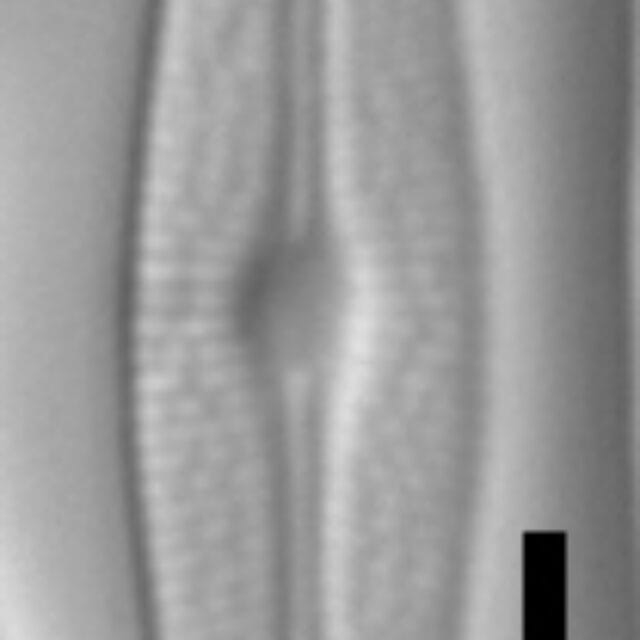 Brachysira neoexilis LM11