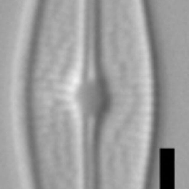 Brachysira neoexilis LM3