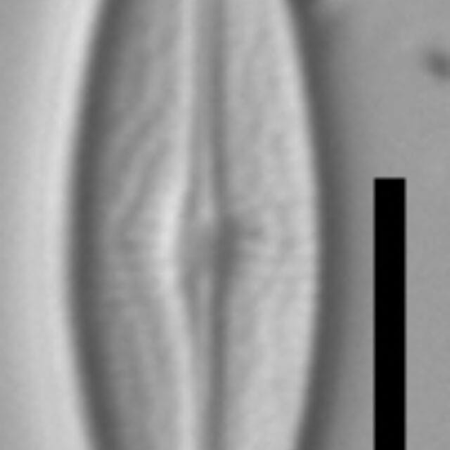 Brachysira neoexilis LM9