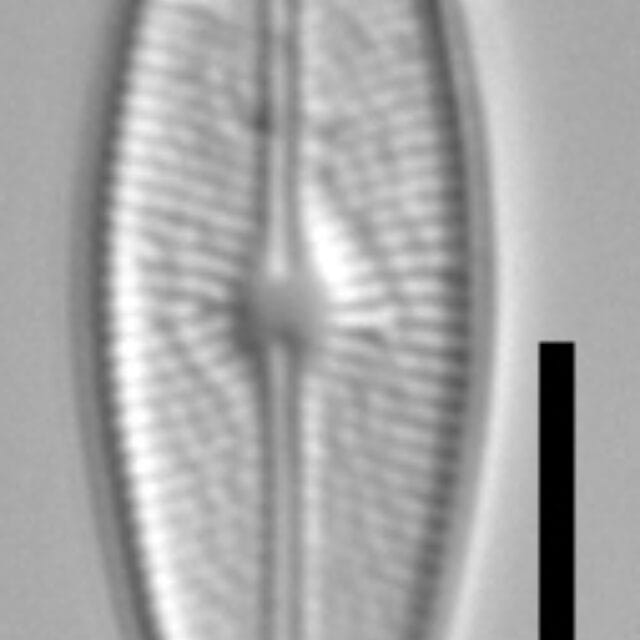 Brachysira vitrea 11 NPS 13296b