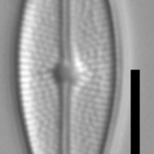 Brachysira vitrea 22 NPS 13296b