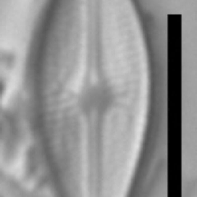 Brachysira vitrea 5 NPS 13263b