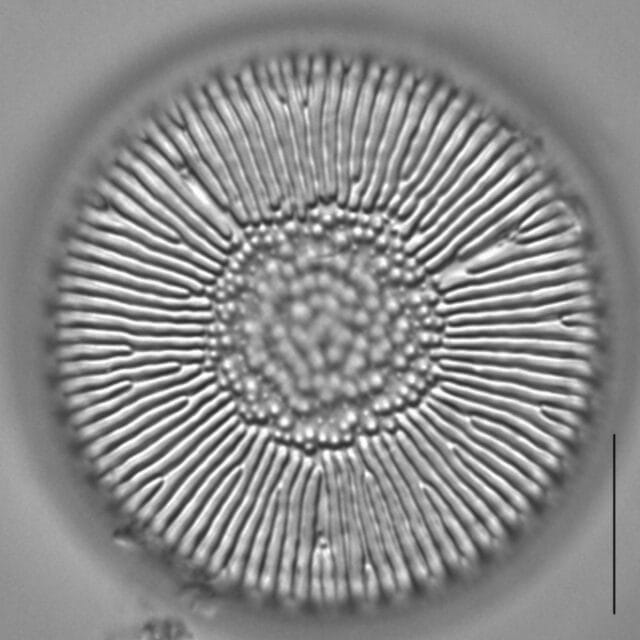 Lindavia intermedia LM2