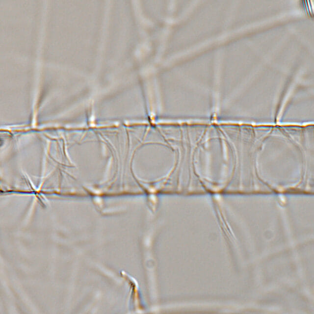 Chaetoceros constrictus LM4