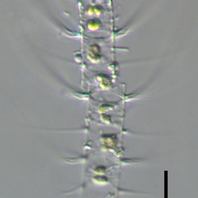 Chaetoceros constrictus LM3 copy