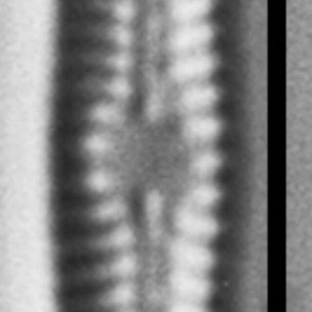 Chamaepinnularia gandrupii LM5