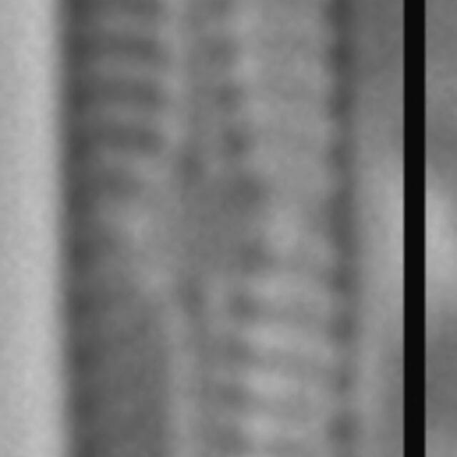 Chamaepinnularia krasskei LM2