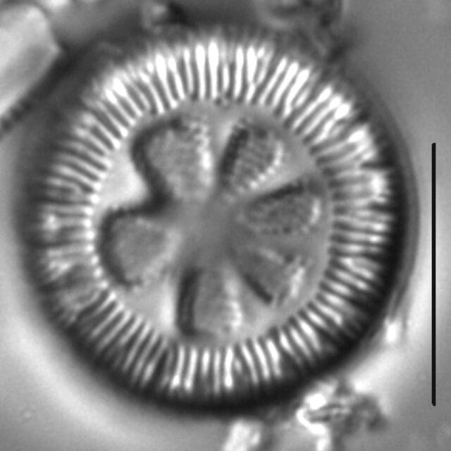 Lindavia antiqua LM7