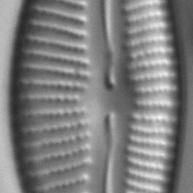 Cymbopleura Citriformis 683101 2