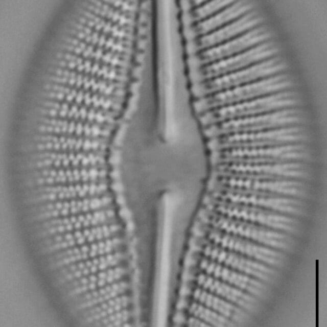 Diploneis dilatata LM1
