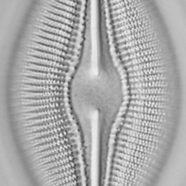 Diploneis dilatata LM5