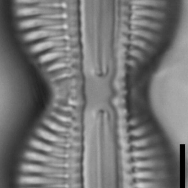 Diploneis interrupta LM1