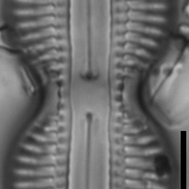 Diploneis interrupta LM2