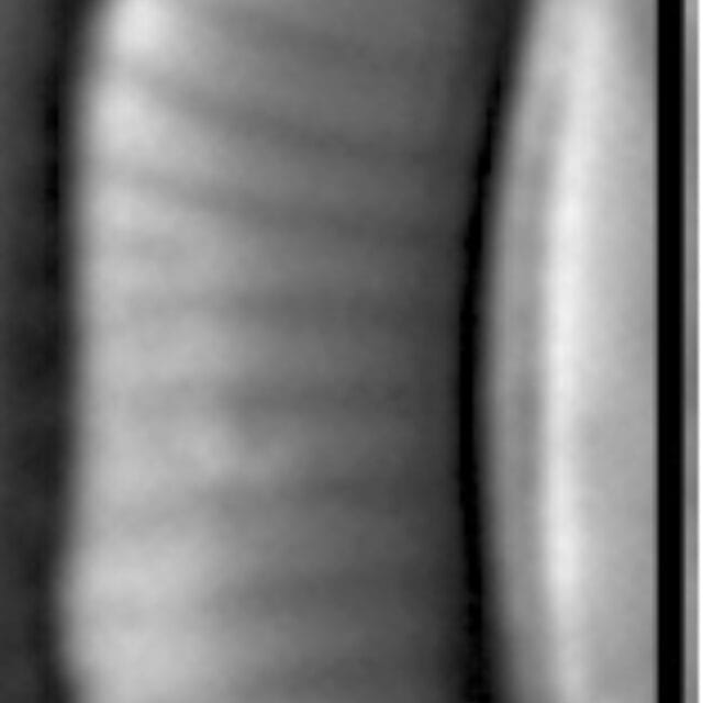 E Orthohedra 2Ndsmall