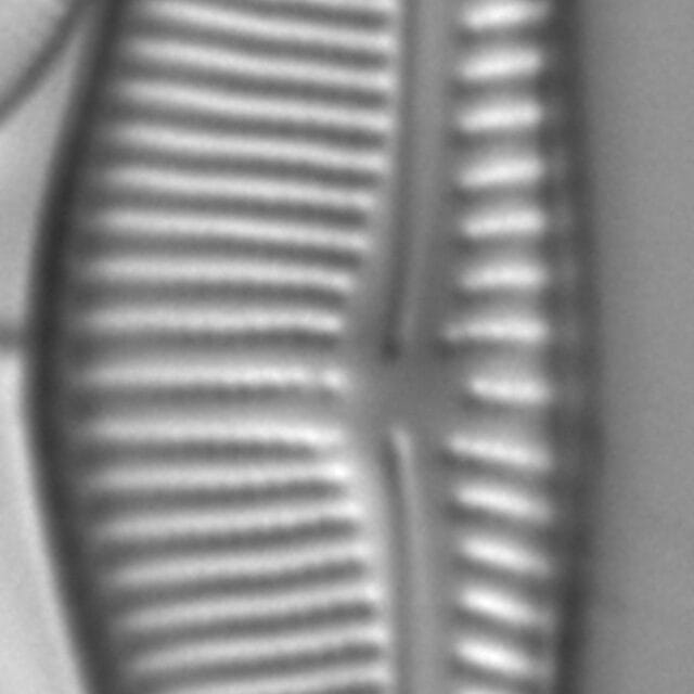 Encyonema Silesiacum LM5