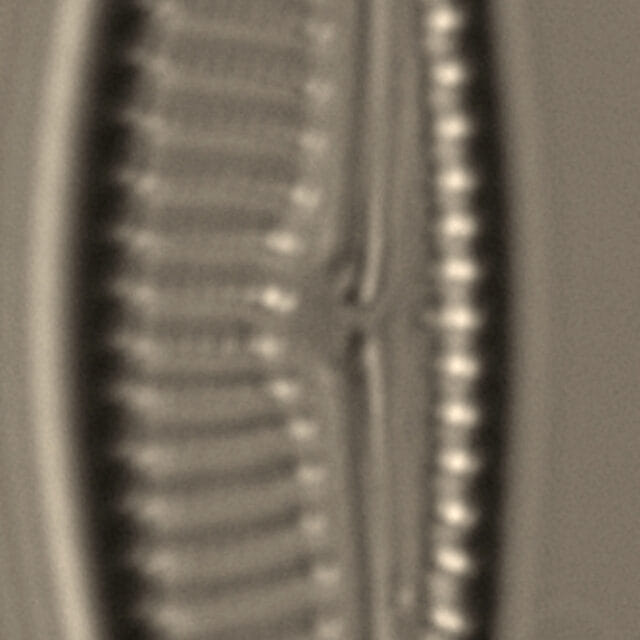 Encyonema silesiacum var elegans_FIU_CERP204853119_04