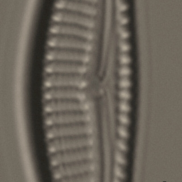 Encyonema silesiacum var elegans_FIU_CERP204853119_05