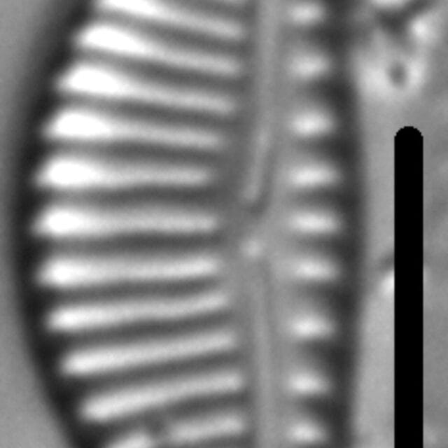 Encyonema Ventricosum 4 397901