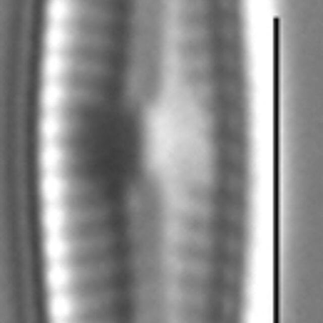 Encyonopsiskutenai 6