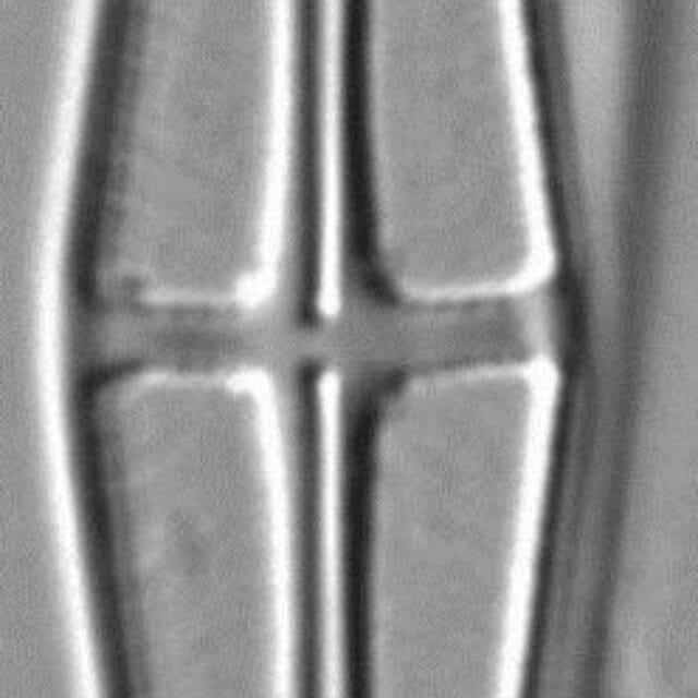 Envekadea pachycephala LM6