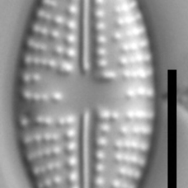 Eolimna metafarta LM5