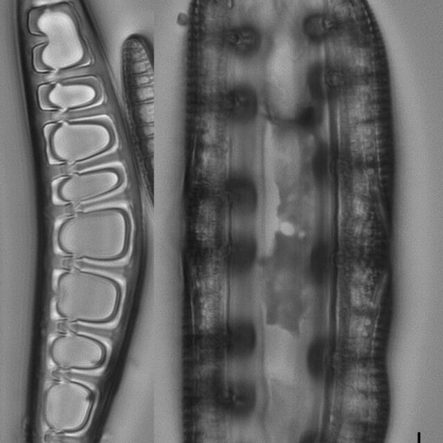 Epithemia Alpestris  Ill2017 07