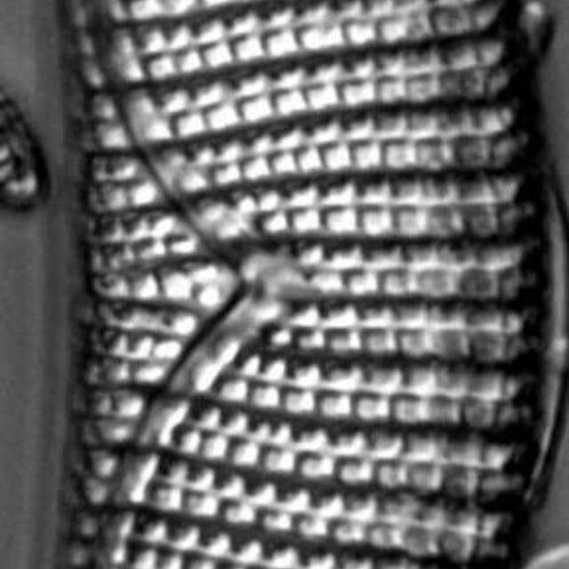 Epithemia turgida LM4