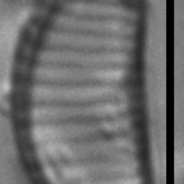 Eunotia boreotenuis LM6 GC8124 B 104