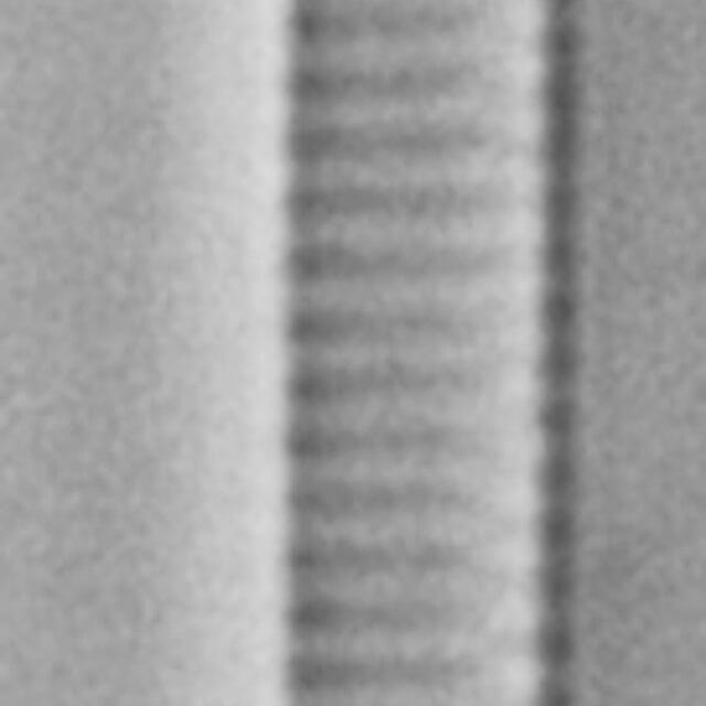 Eunotia romanowii ANSP Siver Egg Harbor0 1 04