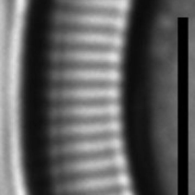 Eunotia nymanniana LM1