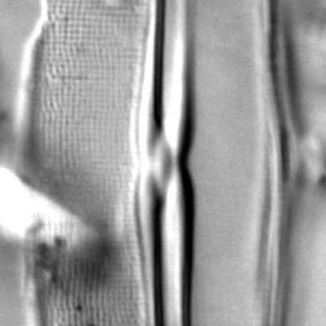 Frustulia Rhomboides Ill Hwarey 1801B 19