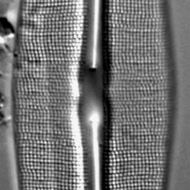 Frustulia Rhomboides Ill Hwarey 1801B 5