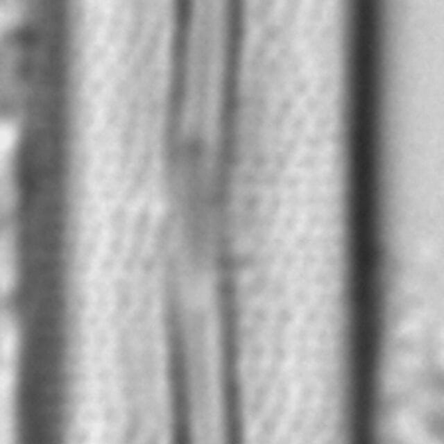  Frustulia amosseana LM6