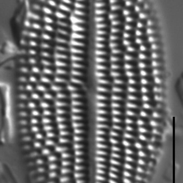 Gc100282  Gs016353  Cclplac1 Ed