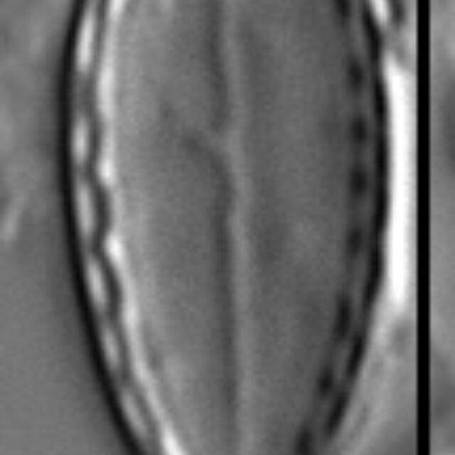 Surirella stalagma LM1
