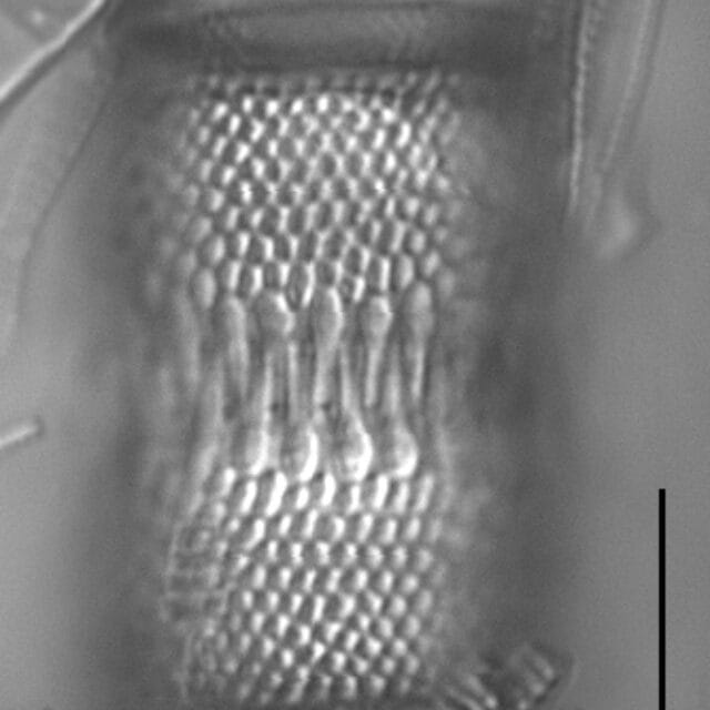 Aulacoseira valida LM5