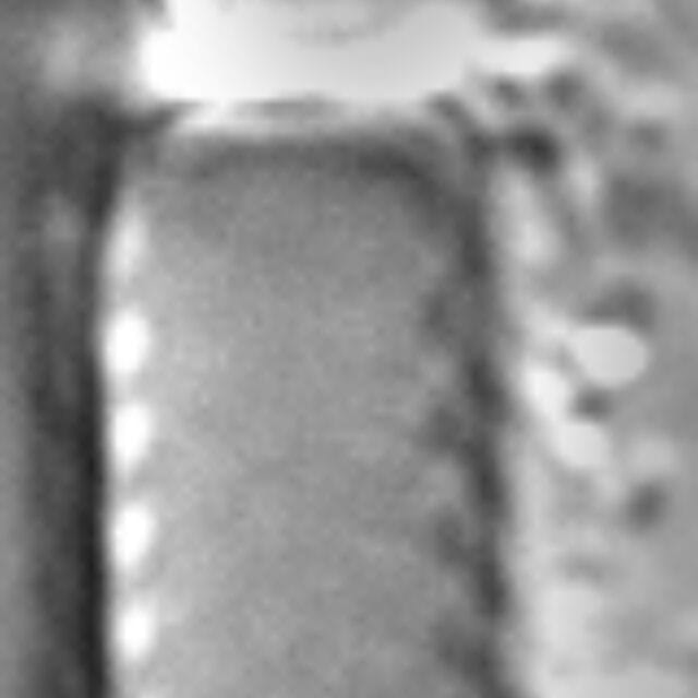 Aulacoseira granulata var. angustissima LM5