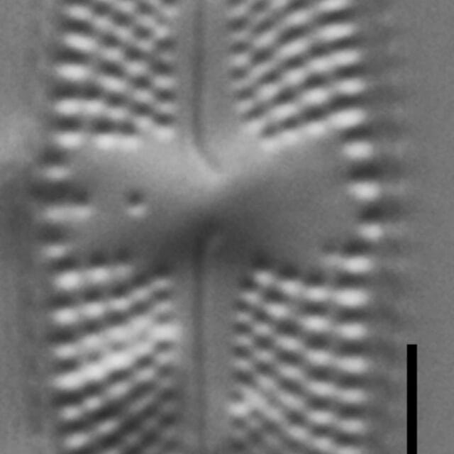 Luticola ventricosa LM1