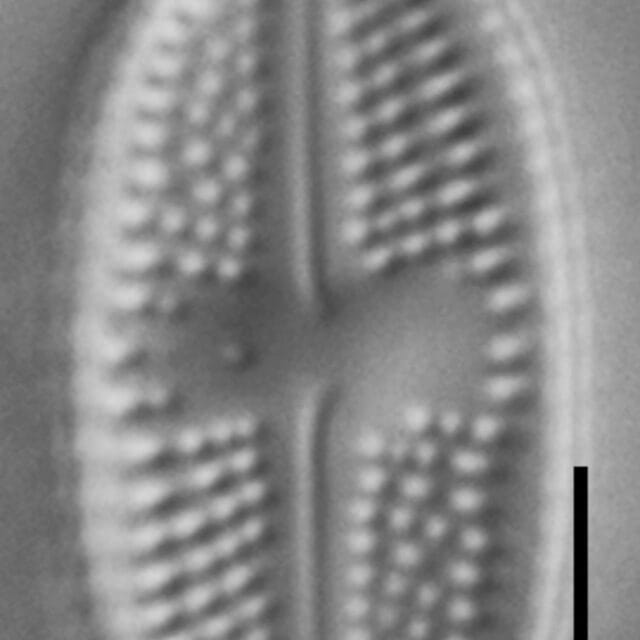 Luticola ventricosa LM7