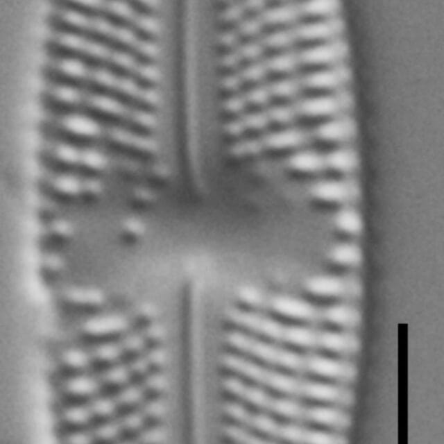 Luticola ventricosa LM3