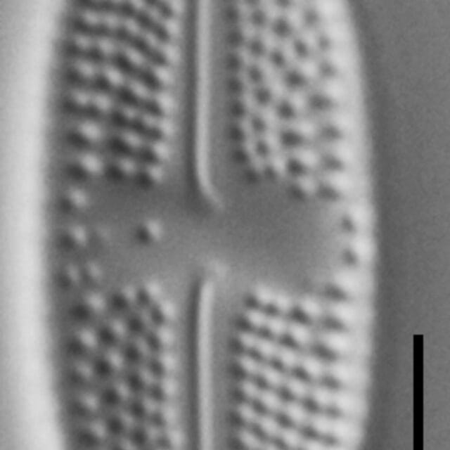 Luticola ventricosa LM5