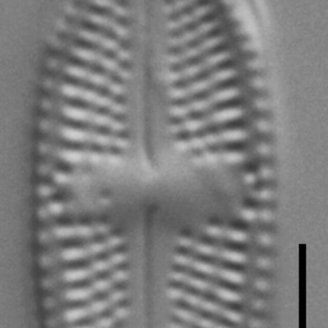 Luticola ventricosa LM6