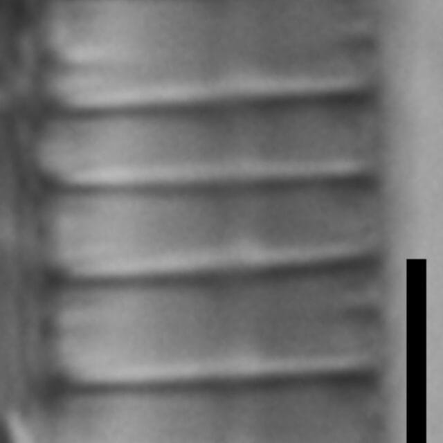 Diatoma problematica LM1
