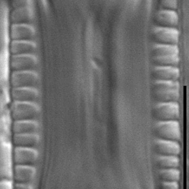 Diatoma problematica LM7