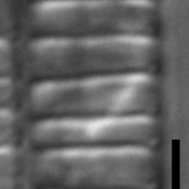 Diatoma problematica LM4