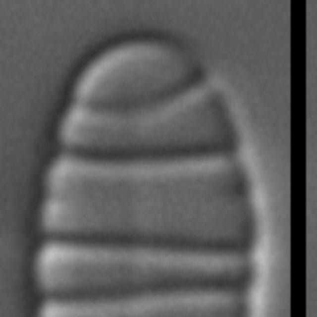 Diatoma problematica LM5