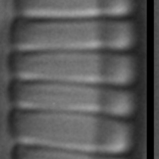 Diatoma problematica LM6