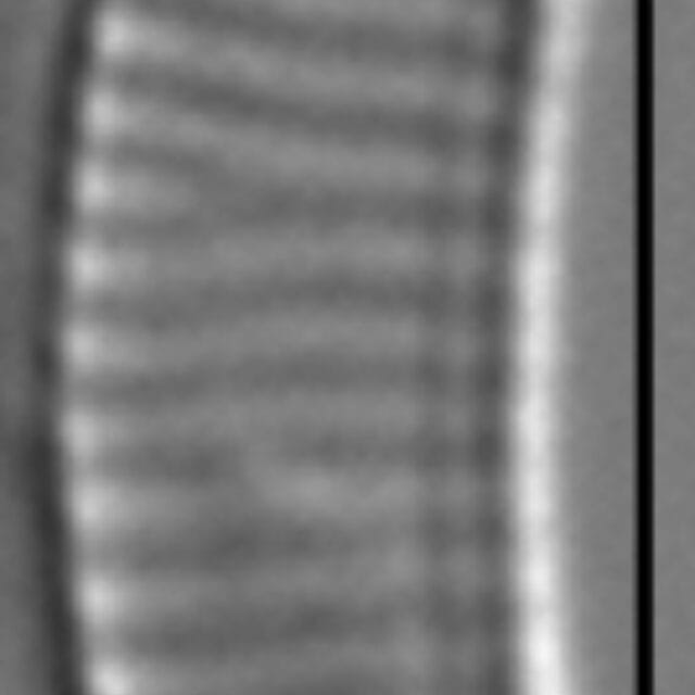 Eunotial tenella LM4